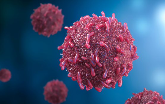 AI-Assisted Anal Cancer Detection